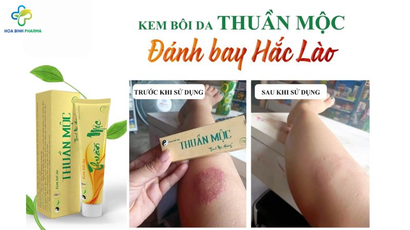 Kem bôi da Thuần Mộc đang nhận được sự tin tưởng nhờ thành phần thảo dược lành tính, phù hợp với làn da người Việt