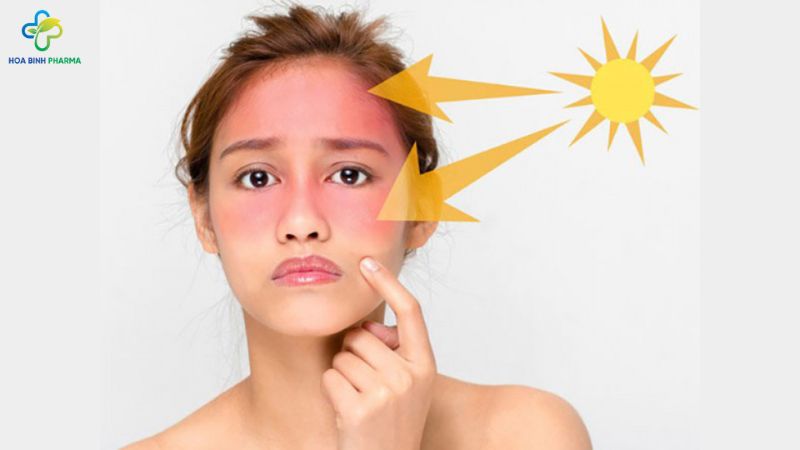 Tình trạng cháy nắng, sạm da, da bị kích ứng nhẹ hoặc nổi mẩn đỏ do phơi nắng quá lâu không còn hiếm gặp
